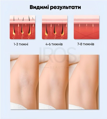 Фотоэпилятор IPL со съемными насадками LESCOLTON T107 - 5 799 грн