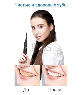 Скалер для видалення зубного каменю ультразвуковий стоматологічний Xpreen 128 - 2 299 грн