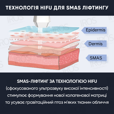 Профессиональный HIFU аппарат для SMAS лифтинга лица NOTIME SKB-2208 HIFU - 19 999 грн