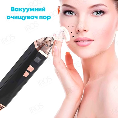 Вакуумный очиститель пор 5в1 с функцией баночного массажа SUYANMEI SY-085 - 2 599 грн