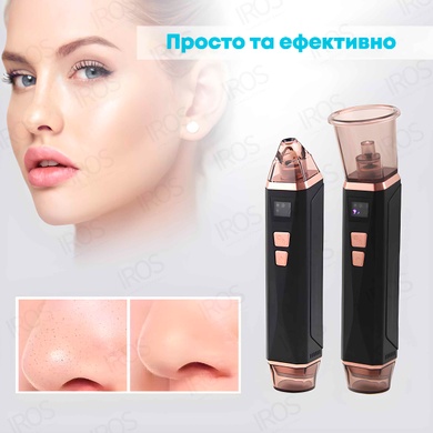 Вакуумный очиститель пор 5в1 с функцией баночного массажа SUYANMEI SY-085 - 2 599 грн