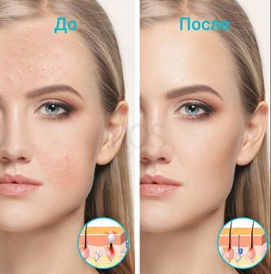 Прилад для догляду за шкірою обличчя з функцією LED терапії XPREEN 052 - 3 599 грн